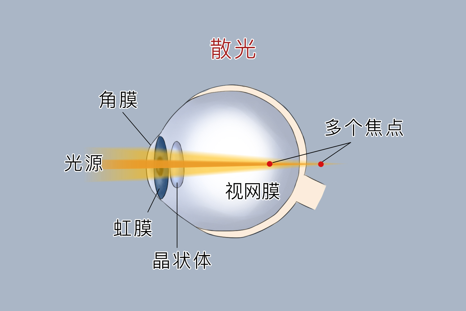 成年散光度数还会涨吗-有来医生