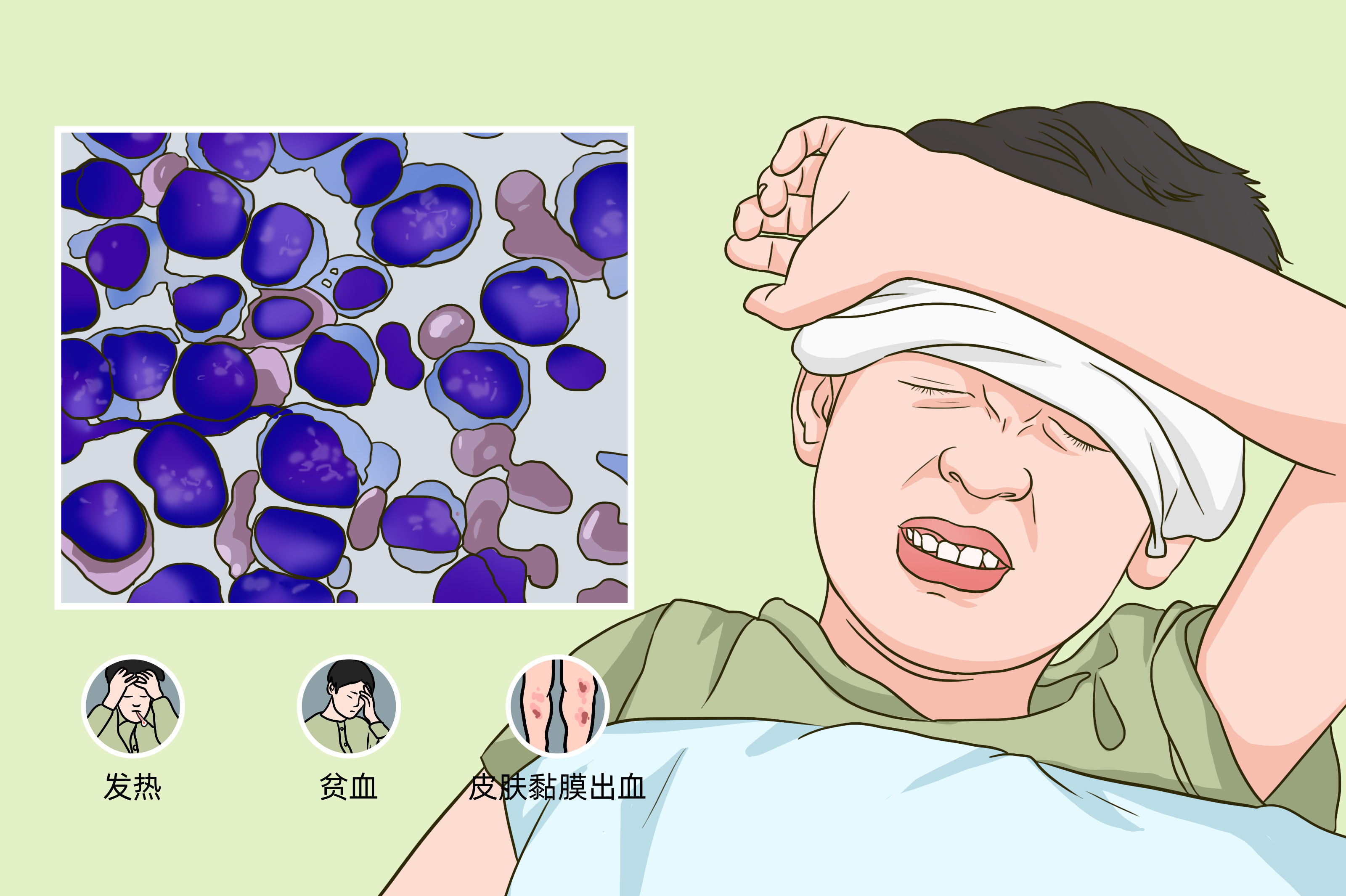 小孩白血病的4个早期信号