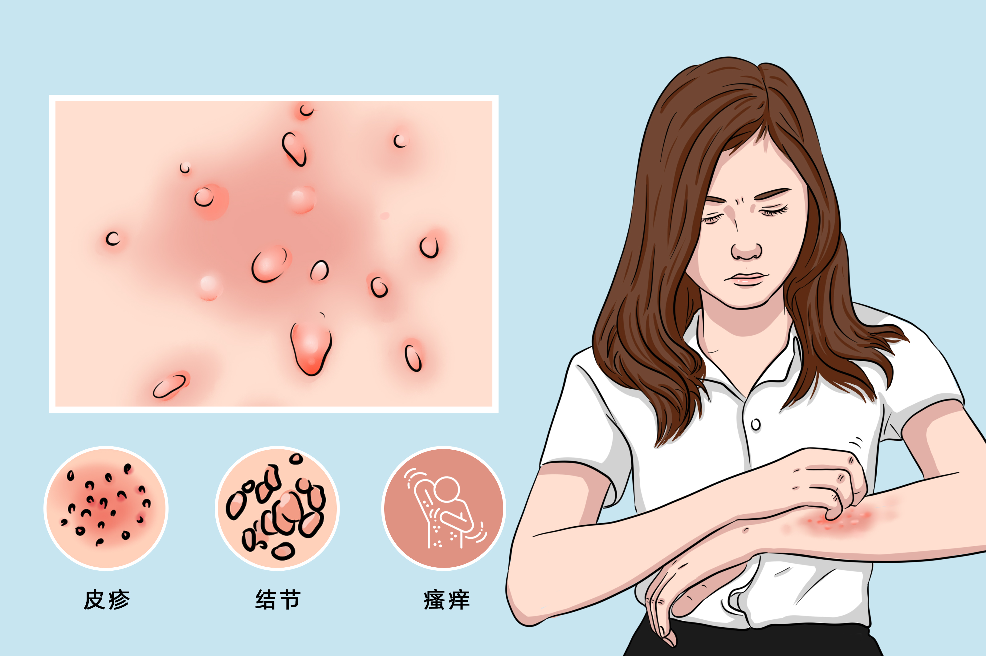 天气热皮肤就痒是什么原因